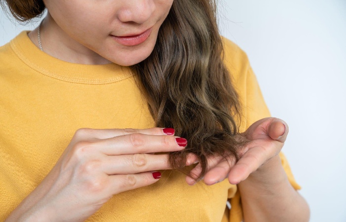 Dry Scalp – Introduction, Symptoms, Causes and More 
