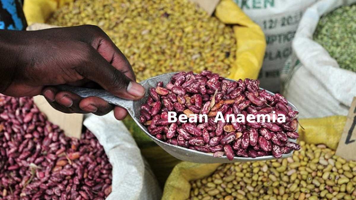 Bean Anaemia – Introduction, Fruits to Avoid and More