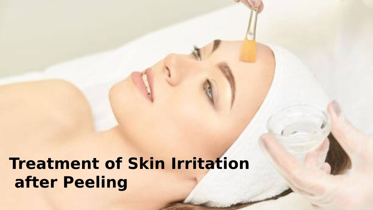Treatment of Skin Irritation after Peeling