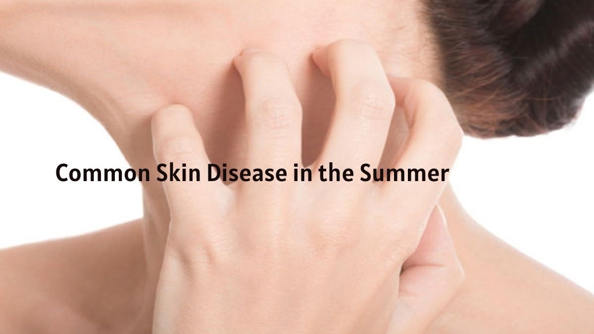 Common Skin Disease in Summer