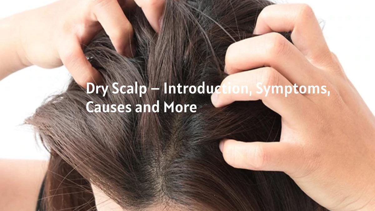 Dry Scalp – Introduction, Symptoms, Causes and More