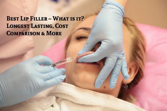 Best Lip Filler