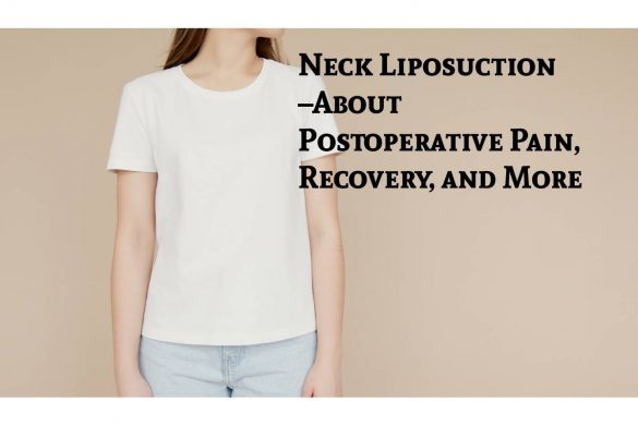 Neck Liposuction