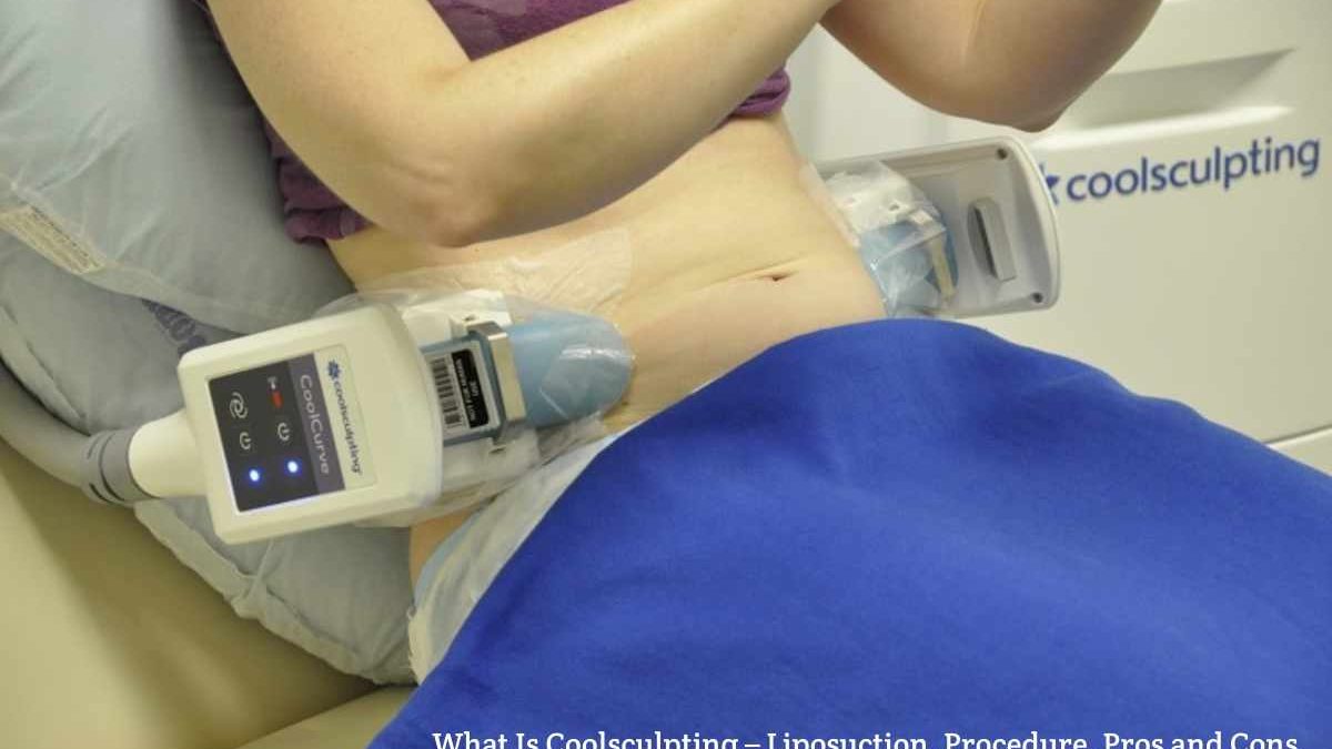 What Is Coolsculpting – Liposuction, Procedure, Pros and Cons