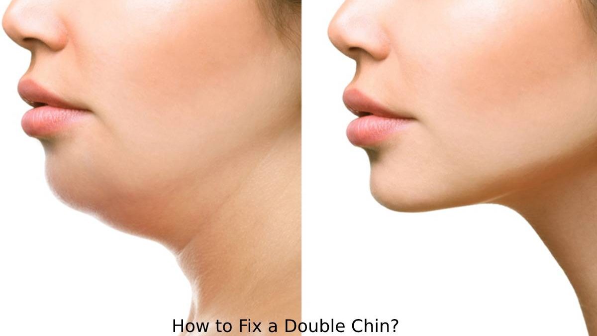 How to Fix a Double Chin?