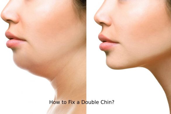 How to Fix a Double Chin