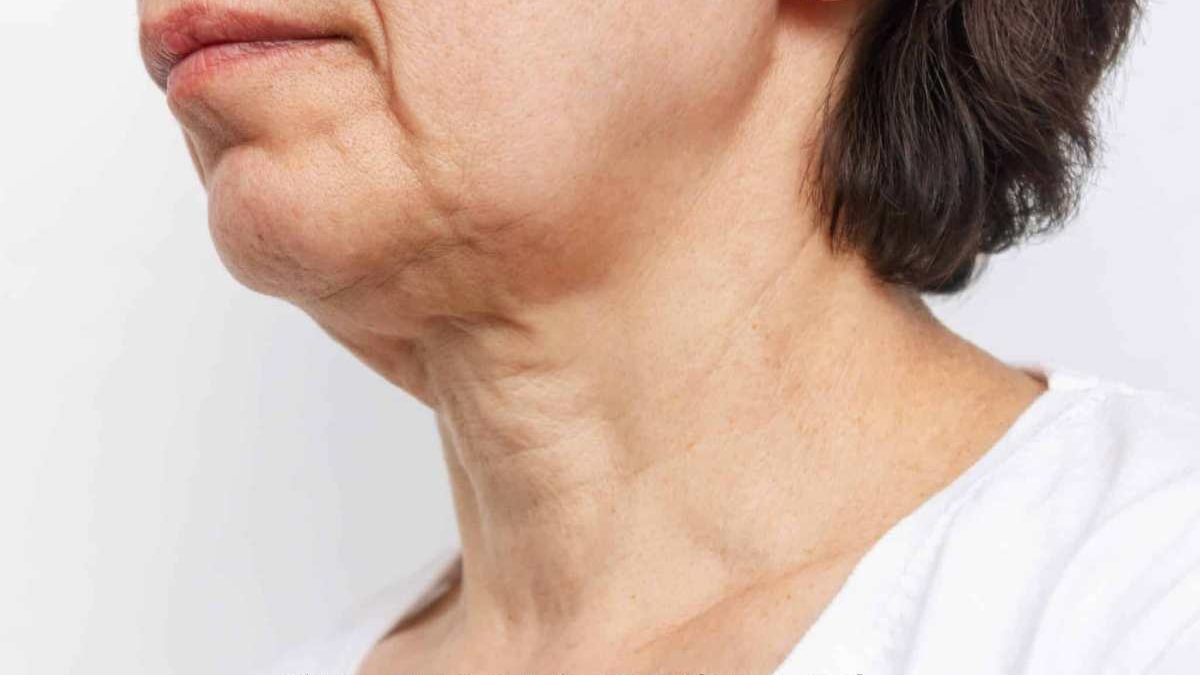 Discover Treatment Options To Combat Saggy Neck