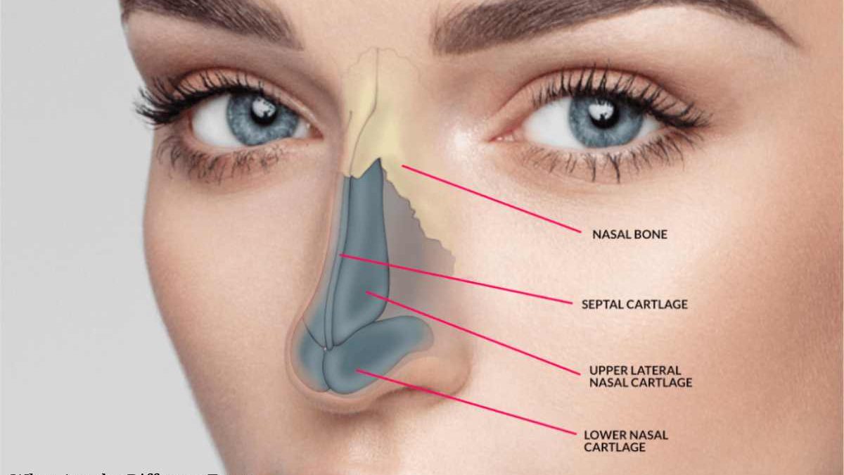 What Are the Different Types of Rhinoplasty