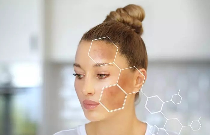 wellhealthorganic.com_lemon-juice-know-home-remedies-easily-remove-dark-spots 