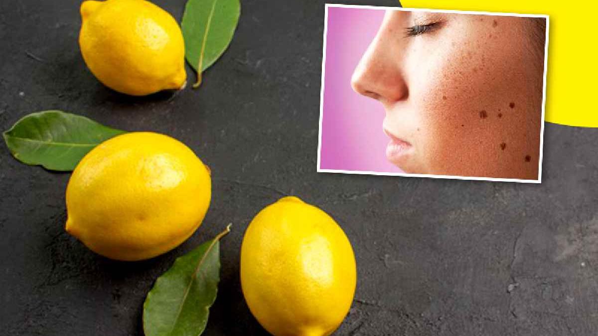 wellhealthorganic.com:lemon-juice-know-home-remedies-easily-remove-dark-spots
