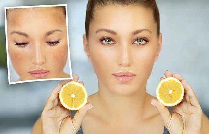 wellhealthorganic.com_lemon-juice-know-home-remedies-easily-remove-dark-spots 