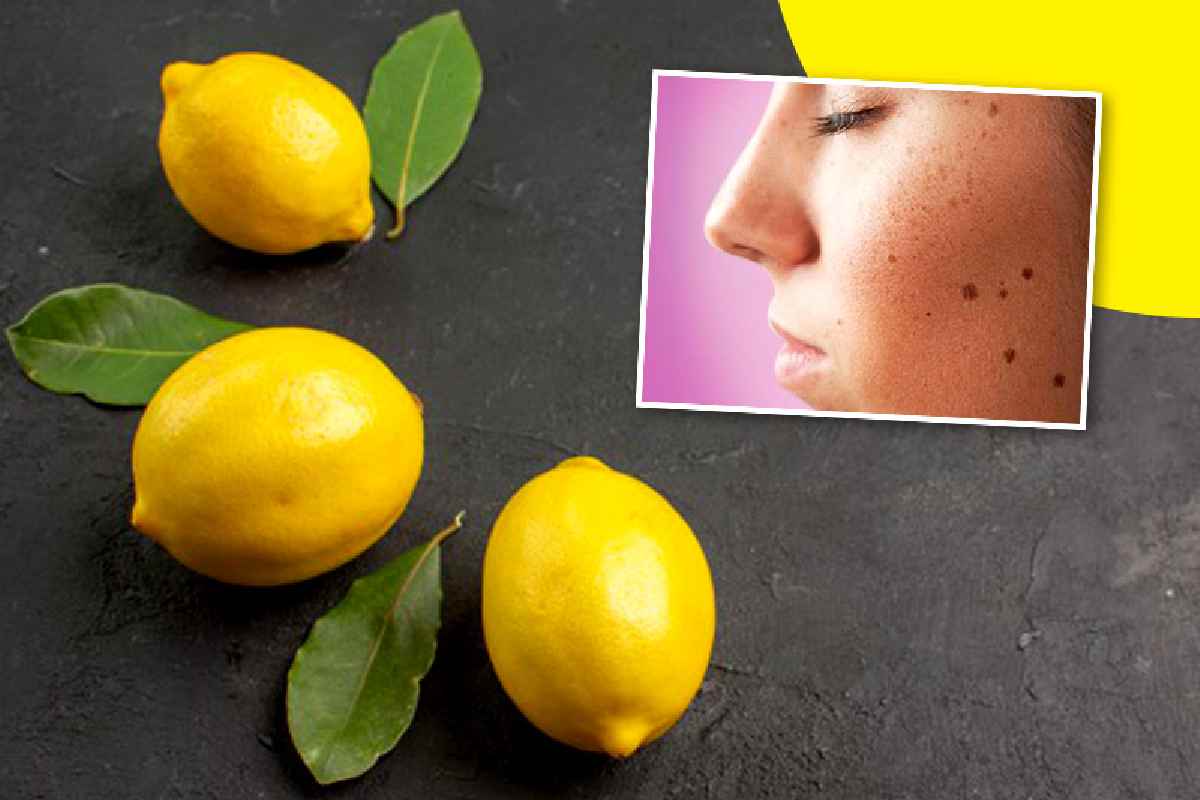 Lemon Juice Know Home Remedies Easily Remove Dark