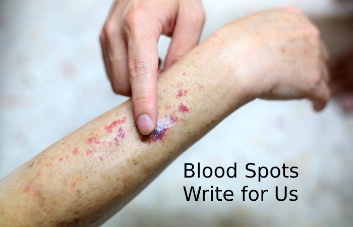 blood spots write for us 