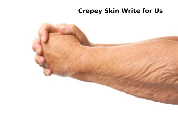 crepey skin write for us 