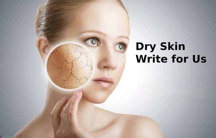 dry skin write for us