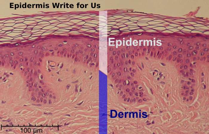 epidermis write for us