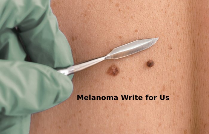 melanoma write for us