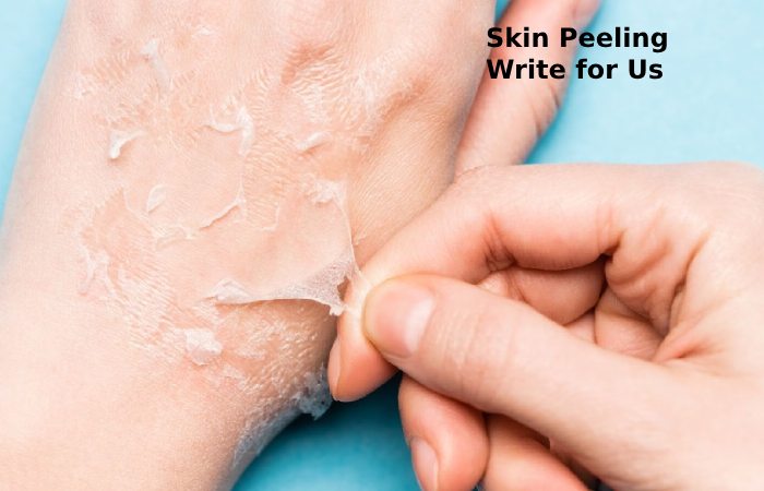 skin peeling write for us