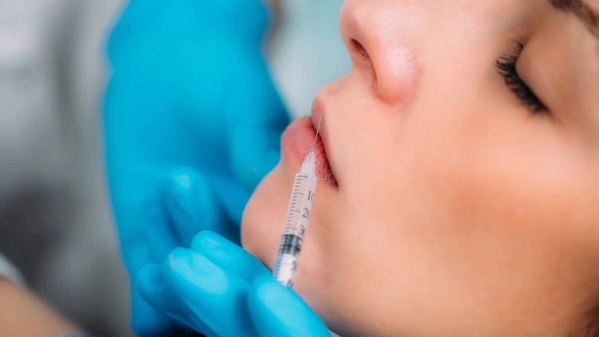 What is the Best Lip Filler – Long Lasting, Comparison & More