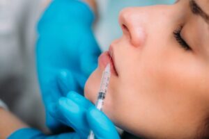 best lip filler